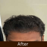 After